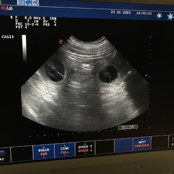 Štěňátka Rhodeský Ridgeback s PP